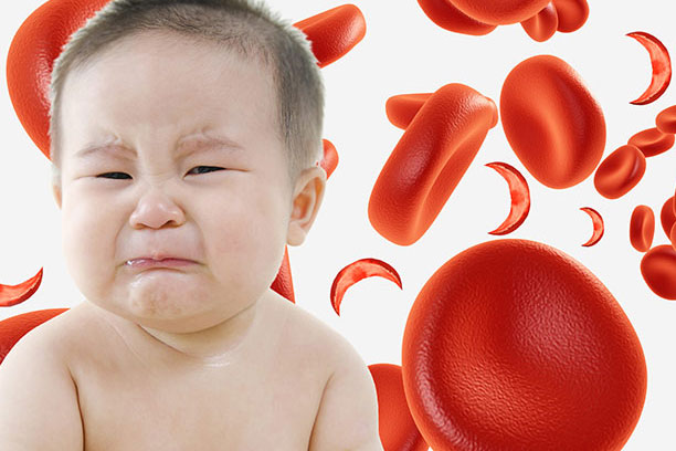 Understanding anemia in kids(causes, symptoms, diagnosis, and treatment)